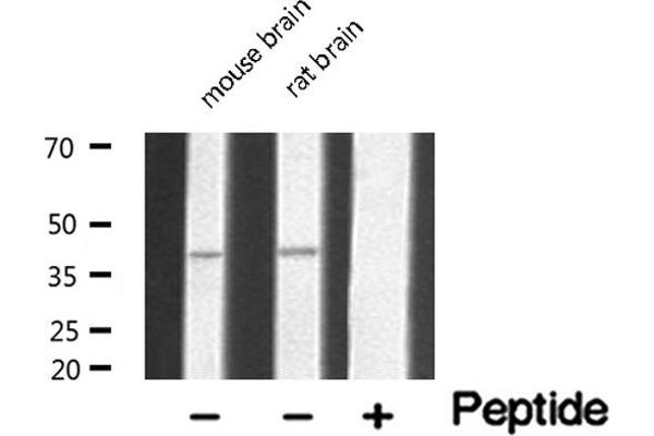 Serotonin Receptor 5A anticorps  (Internal Region)