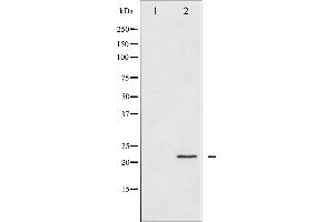 Western blot analysis of CPI17alpha expression in HT29 whole cell lysates,The lane on the left is treated with the antigen-specific peptide. (CPI-17 anticorps  (Internal Region))