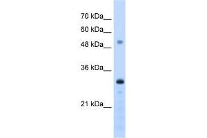 WB Suggested Anti-PSME3 Antibody Titration:  1. (PSME3 anticorps  (C-Term))