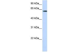 WB Suggested Anti-FBXO24 Antibody Titration:  0. (FBXO24 anticorps  (N-Term))