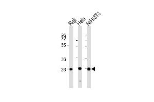 All lanes : Anti-PSMB7 Antibody (Center) at 1:2000 dilution Lane 1: Raji whole cell lysates Lane 2: Hela whole cell lysates Lane 3: NIH/3T3 whole cell lysates Lysates/proteins at 20 μg per lane. (PSMB7 anticorps  (AA 180-211))