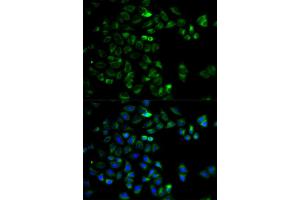 Immunofluorescence analysis of HeLa cells using HTRA2 antibody (ABIN5973384). (HTRA2 anticorps)