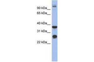 Image no. 1 for anti-Biglycan (BGN) (AA 215-264) antibody (ABIN6744047) (Biglycan anticorps  (AA 215-264))