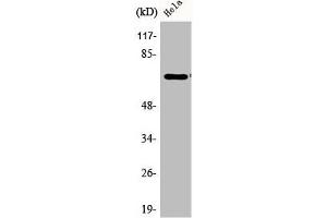 Western Blot analysis of HeLa cells using Phospho-Paxillin (Y31) Polyclonal Antibody (Paxillin anticorps  (pTyr31))