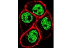 Immunofluorescence (IF) image for anti-Parafibromin (CDC73) antibody (ABIN3004068) (HRPT2 anticorps)