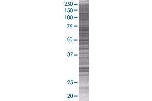 ALDH7A1 transfected lysate. (ALDH7A1 293T Cell Transient Overexpression Lysate(Denatured))