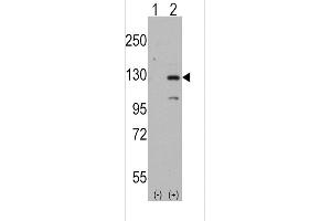 Western blot analysis of DAAM1 using rabbit polyclonal DAAM1 Antibody(Human N-term) using 293 cell lysates (2 ug/lane) either nontransfected (Lane 1) or transiently transfected with the DAAM1 gene (Lane 2). (DAAM1 anticorps  (N-Term))