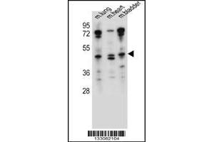 Western blot analysis in mouse lung,heart,bladder tissue lysates (35ug/lane). (NKD1 anticorps  (N-Term))