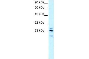 WB Suggested Anti-RGS20 Antibody Titration:  2. (RGS20 anticorps  (Middle Region))