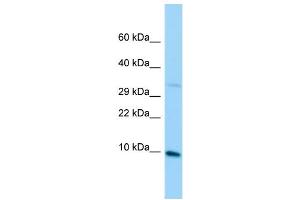 Host: Rabbit Target Name: MRPL36 Sample Type: Jurkat Whole Cell lysates Antibody Dilution: 1. (MRPL36 anticorps  (C-Term))