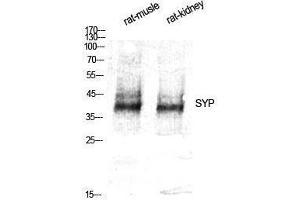 Western Blotting (WB) image for anti-Synaptophysin (SYP) (Internal Region) antibody (ABIN3187137) (Synaptophysin anticorps  (Internal Region))