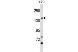 Western Blotting (WB) image for anti-Phosphatidylinositol Glycan Anchor Biosynthesis, Class O (PIGO) antibody (ABIN2999333) (PIGO anticorps)