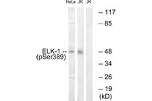 Western Blotting (WB) image for anti-ELK1, Member of ETS Oncogene Family (ELK1) (pSer389) antibody (ABIN2888404) (ELK1 anticorps  (pSer389))