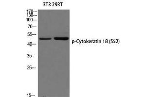 Western Blot (WB) analysis of 3T3 293T using p-Cytokeratin 18 (S52) antibody. (Cytokeratin 18 anticorps  (pSer52))