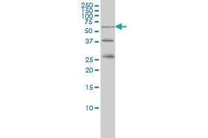 RIOK3 monoclonal antibody (M02A), clone 3G11 Western Blot analysis of RIOK3 expression in K-562 . (RIOK3 anticorps  (AA 411-516))