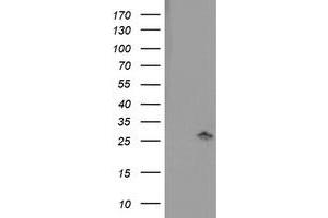 HEK293T cells were transfected with the pCMV6-ENTRY control (Left lane) or pCMV6-ENTRY PNPO (Right lane) cDNA for 48 hrs and lysed. (PNPO anticorps)