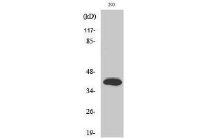 Western Blotting (WB) image for anti-ISL LIM Homeobox 2 (ISL2) (Internal Region) antibody (ABIN3185245) (ISL2 anticorps  (Internal Region))