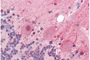 Human Brain, Cerebellum (formalin-fixed, paraffin-embedded) stained with SIRT2 antibody ABIN461916 at 5 ug/ml followed by biotinylated goat anti-rabbit IgG secondary antibody ABIN481713, alkaline phosphatase-streptavidin and chromogen. (SIRT2 anticorps  (N-Term))