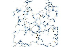 Immunohistochemistry (Paraffin-embedded Sections) (IHC (p)) image for anti-Lymphocyte Antigen 6 Complex, Locus G (Ly6g) antibody (ABIN7074524)