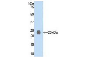 Detection of Recombinant NEP, Human using Polyclonal Antibody to Neprilysin (CD10) (MME anticorps  (AA 565-750))