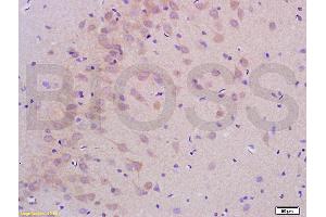 Formalin-fixed and paraffin embedded rat brain labeled with Anti-PHOSPHO-LLGL1 + LLGL2(SER650+SER654) Antibody, Unconjugated (ABIN761981) at 1:200 followed by conjugation to the secondary antibody and DAB staining (LLGL1 + LLGL2 (pSer650), (pSer654) anticorps)