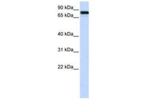 Image no. 1 for anti-Ewing Sarcoma Breakpoint Region 1 (EWSR1) (AA 216-265) antibody (ABIN6743005) (EWSR1 anticorps  (AA 216-265))