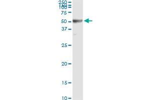 Immunoprecipitation (IP) image for anti-Ribonucleotide Reductase M2 (RRM2) (AA 1-110) antibody (ABIN562744)