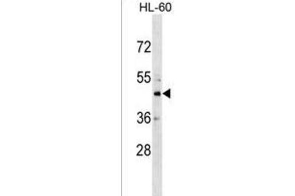 CHST10 anticorps  (C-Term)