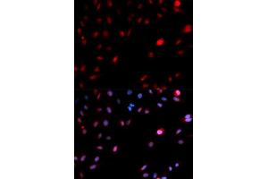Immunofluorescence (IF) image for anti-Cyclin-Dependent Kinase 1 (CDK1) (pTyr15) antibody (ABIN1870049) (CDK1 anticorps  (pTyr15))