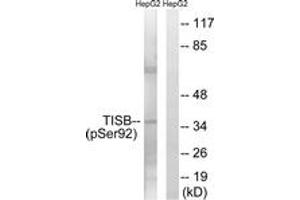 Western blot analysis of extracts from HepG2 cells, using TISB (Phospho-Ser92) Antibody. (ZFP36L1 anticorps  (pSer92))