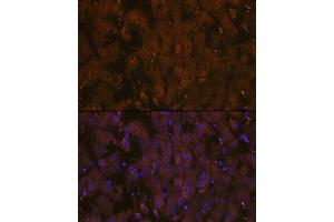 Immunofluorescence analysis of human liver using MSP/MST1 Rabbit mAb (ABIN1680891, ABIN1680890, ABIN3015057 and ABIN3015058) at dilution of 1:100 (40x lens). (MST1 anticorps)