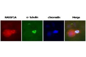 Image no. 2 for anti-Ras Association (RalGDS/AF-6) Domain Family Member 1 (RASSF1) antibody (ABIN165456) (RASSF1 anticorps)