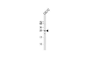Anti-Mouse p27Kip1 Antibody (C-term ) at 1:1000 dilution + C2C12 whole cell lysate Lysates/proteins at 20 μg per lane. (CDKN1B anticorps  (C-Term))