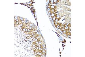 Immunohistochemistry of paraffin-embedded rat testis using TST Rabbit pAb  at dilution of 1:200 (40x lens). (TST anticorps  (AA 1-297))