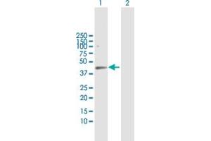 Western Blot analysis of HDAC8 expression in transfected 293T cell line by HDAC8 MaxPab polyclonal antibody. (HDAC8 anticorps  (AA 1-377))