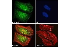 ABIN940568 Immunofluorescence analysis of paraformaldehyde fixed HeLa cells, permeabilized with 0. (TERT anticorps  (AA 597-611))