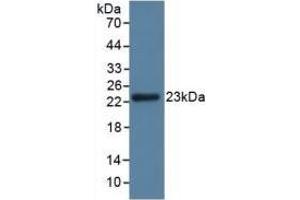 Detection of GPX3 in Rat Kidney Tissue using Polyclonal Antibody to Glutathione Peroxidase 3, Plasma (GPX3) (GPX3 anticorps  (AA 3-72))