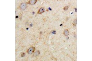 Immunohistochemical analysis of MAP2 staining in human brain formalin fixed paraffin embedded tissue section. (MAP2 anticorps  (N-Term))