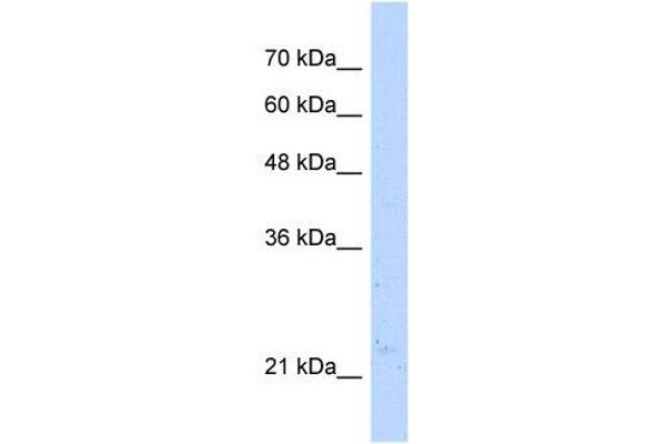 NUDT16L1 anticorps