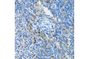 Immunohistochemistry of paraffin-embedded mouse spleen using UBE2D1 antibody (ABIN5971011) at dilution of 1/100 (40x lens). (UBE2D1 anticorps)