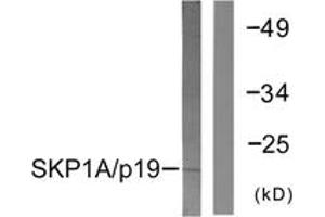 Western blot analysis of extracts from COS7 cells, using SKP1A/p19 Antibody. (SKP1 anticorps  (AA 41-90))