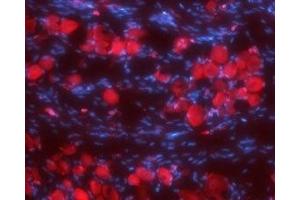 Expression of Synaptophysin in rat DRG - Immunohistochemical staining of rat dorsal root ganglia (DRG) frozen sections using Anti-Synaptophysin Antibody (ABIN7043791, ABIN7044656 and ABIN7044657), (1:100). (Synaptophysin anticorps  (Intravesicular Loop))