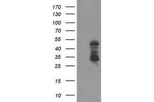 Western Blotting (WB) image for anti-ELK3, ETS-Domain Protein (SRF Accessory Protein 2) (ELK3) antibody (ABIN1498006) (ELK3 anticorps)