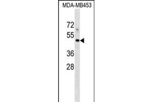 Western Blotting (WB) image for anti-Major Histocompatibility Complex, Class I-Related (MR1) (AA 312-341), (C-Term) antibody (ABIN1537116)