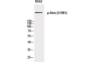 Western Blotting (WB) image for anti-Ataxia Telangiectasia Mutated (ATM) (pSer1981) antibody (ABIN5955782) (ATM anticorps  (pSer1981))