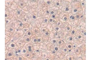 DAB staining on IHC-P; Samples: Human Liver Tissue (PLGF anticorps  (AA 43-162))