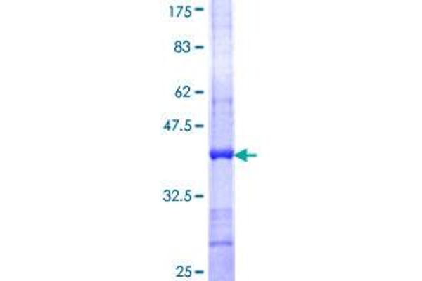 Dual Specificity Phosphatase 3 (DUSP3) (AA 76-185) protein (GST tag)