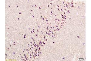 Immunohistochemistry (Paraffin-embedded Sections) (IHC (p)) image for anti-Fibroblast Growth Factor 2 (Basic) (FGF2) (AA 143-250) antibody (ABIN726425)