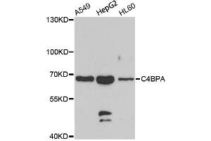 Western blot analysis of extracts of various cell lines, using C4BPA antibody (ABIN5975151) at 1/1000 dilution. (C4BPA anticorps)