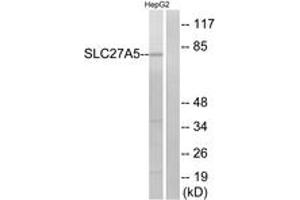 Western blot analysis of extracts from HepG2 cells, using SLC27A5 Antibody. (SLC27A5 anticorps  (AA 481-530))
